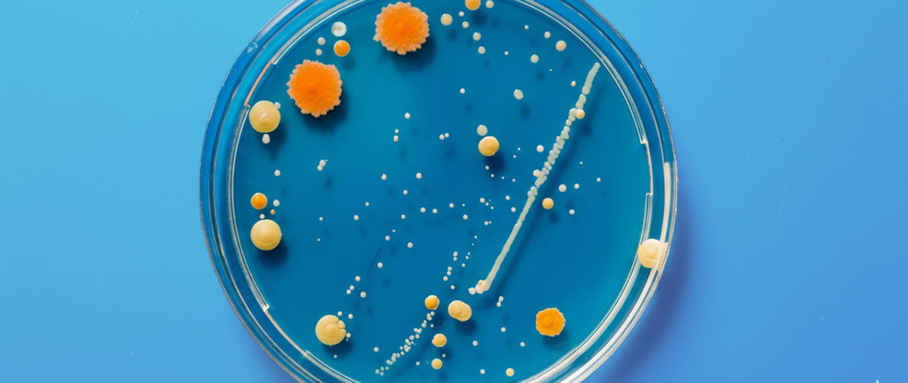 Toksoplasmosis: Penyebab, Gejala, dan Pengaruhnya terhadap Reproduksi Perempuan