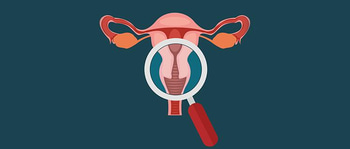 Alergi Kulit di Sekitar Vagina
